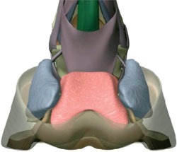 Equine digital cushion and rehabilitation